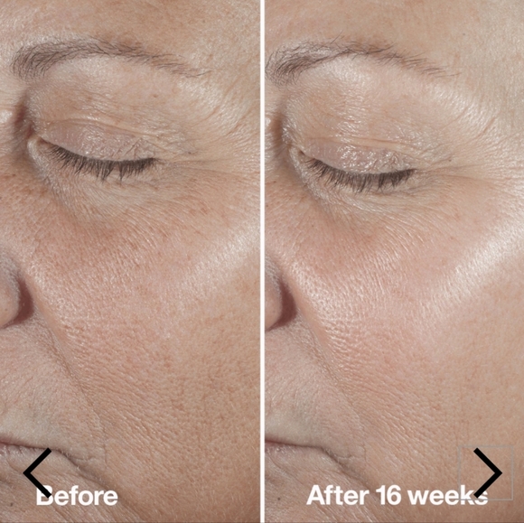 CLINIQUE Smart Clinical Repair Wrinkle Correcting Serum - Picture 4 of 12